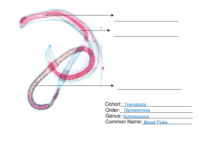 Cohort: Trematoda
Order: Diplostomida
Genus: Schistosoma
Common Name: Blood Fluke