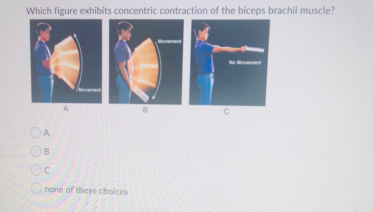 Which figure exhibits concentric contraction of the biceps brachii muscle?
Movement
No Movement
/Movement
A
OA
Oc
O none of these choices
