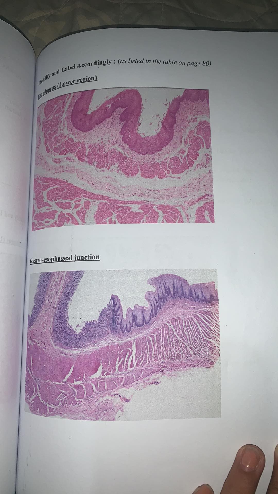 Identify and Label Accordingly: (as listed in the table on page 80)
Esophagus (Lower region)
Gastro-esophageal junction
ad M
N