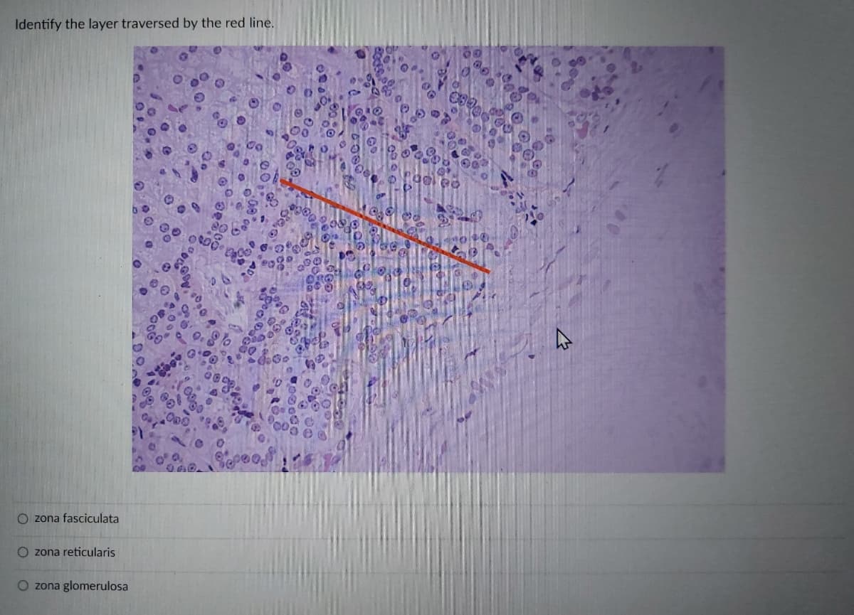 Identify the layer traversed by the red line.
Ozona fasciculata
O zona reticularis
O zona glomerulosa
800
10led