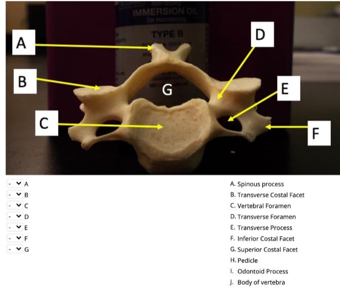 IMMERSION OIL
for microscop
TYPE B
D
A
COD
E
F
A
A. Spinous process
V B
B. Transverse Costal Facet
C. Vertebral Foramen
D. Transverse Foramen
E. Transverse Process
F. Inferior Costal Facet
v G
G. Superior Costal Facet
H. Pedicle
I. Odontoid Process
J. Body of vertebra
B
