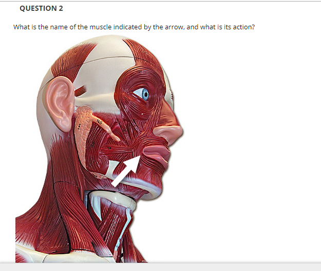 QUESTION 2
What is the name of the muscle indicated by the arrow, and what is its action?
