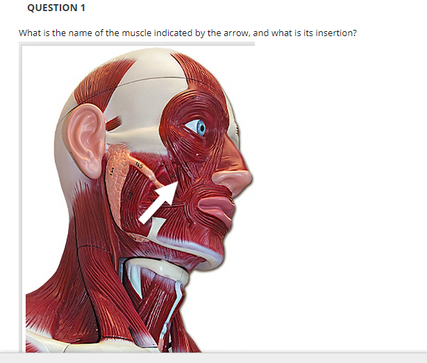 QUESTION 1
What is the name of the muscle indicated by the arrow, and what is its insertion?
145
