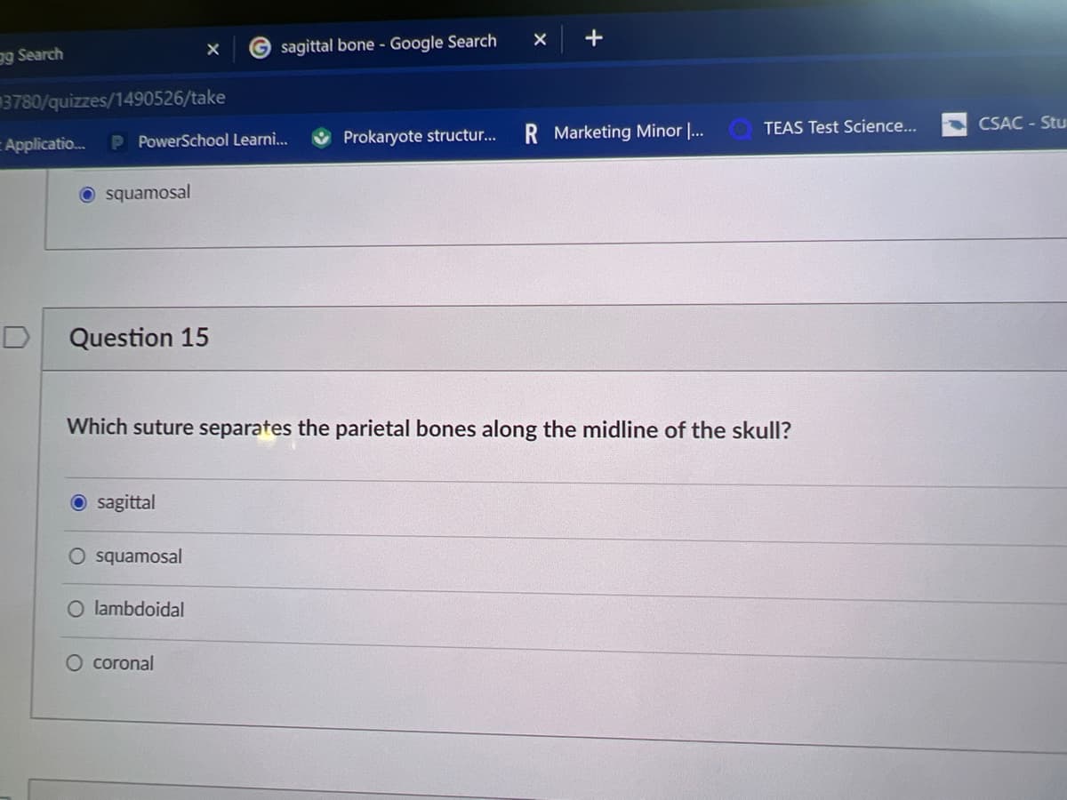 g Search
3780/quizzes/1490526/take
Applicatio... P PowerSchool Learni...
squamosal
D Question 15
sagittal
O squamosal
Gsagittal bone - Google Search
lambdoidal
O coronal
Prokaryote structur...
Which suture separates the parietal bones along the midline of the skull?
X +
R Marketing Minor I...
TEAS Test Science...
CSAC-Stu