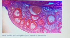 What process is occurring hereINOT the tyoe of cell division
