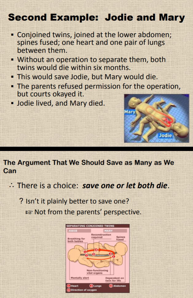 Second Example: Jodie and Mary
Conjoined twins, joined at the lower abdomen;
spines fused; one heart and one pair of lungs
between them.
- Without an operation to separate them, both
twins would die within six months.
• This would save Jodie, but Mary would die.
• The parents refused permission for the operation,
but courts okayed it.
• Jodie lived, and Mary died.
Mary
Jodie
The Argument That We Should Save as Many as We
Can
.. There is a choice: save one or let both die.
? Isn't it plainly better to save one?
* Not from the parents' perspective.
SEPARATING CONJOINED TWINS
JODIE
MARY
Reconstruction
required
Spines
Breathing for
both babies
Non-functioning
vital organs
Mentally alert
Dependent on
twin for life
O Heart
O Direction of oxygen
OLungs
Abdomen
