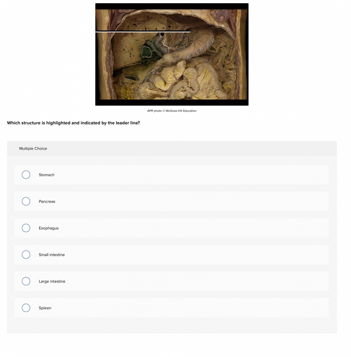 APR photo O McGraw-Hill Education
Which structure is highlighted and indicated by the leader line?
Multiple Choice
Stomach
Pancreas
Esophagus
Small intestine
Large intestine
Spleen
