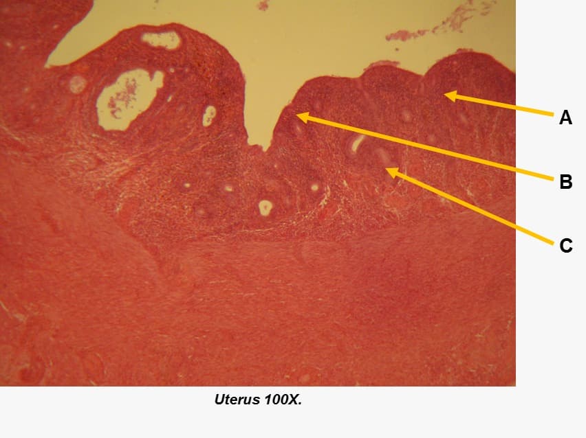 A
В
Uterus 100X.
