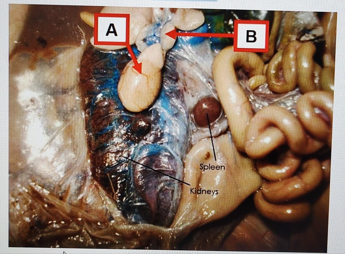 A
Spleen
Kidneys
B