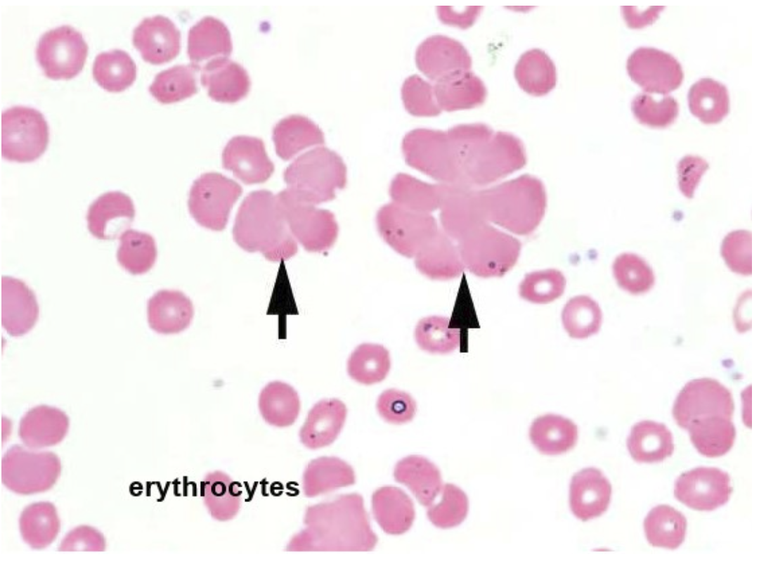 erythrocytes
