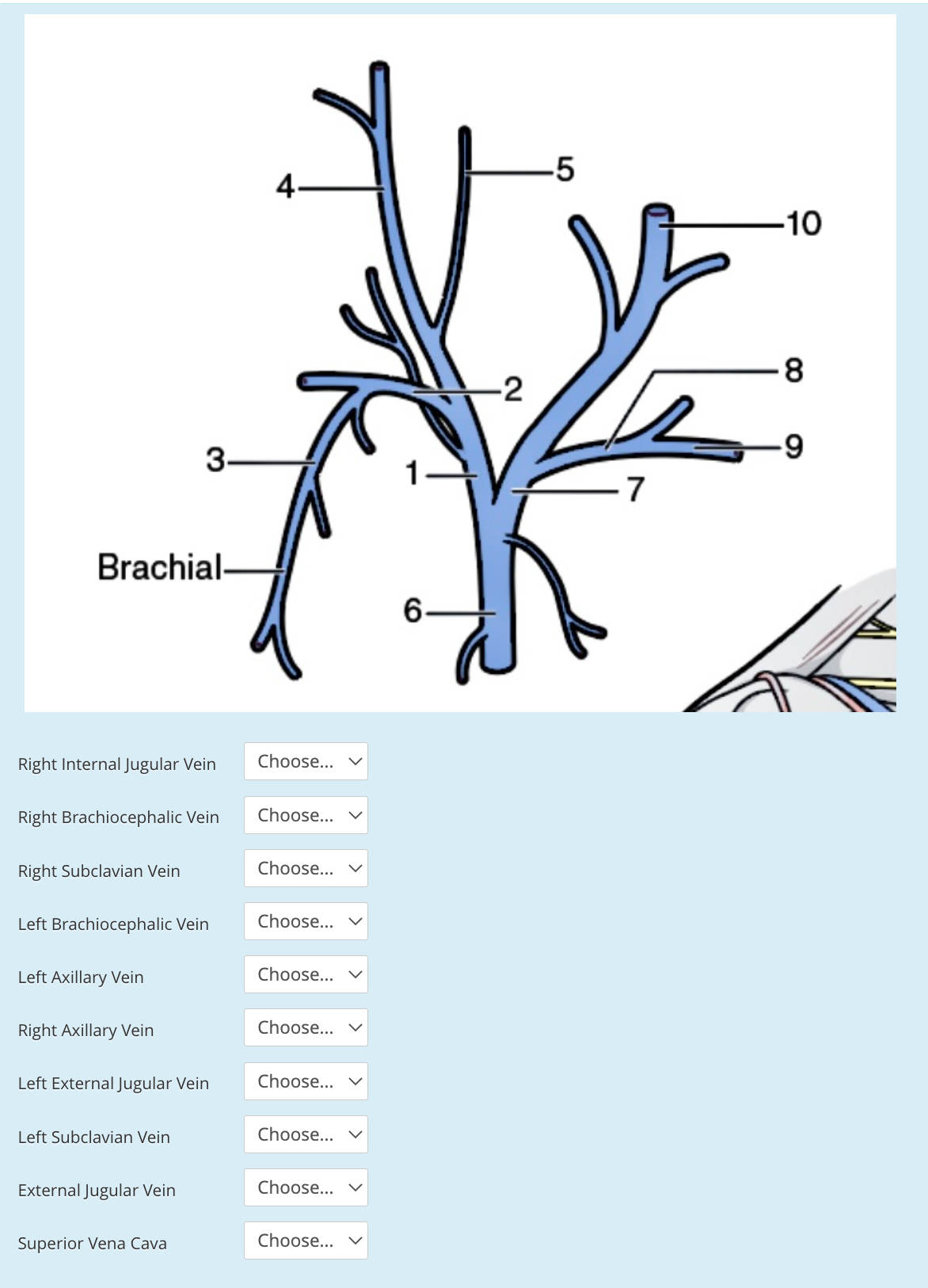 -5
4-
-10
8.
-2
3-
7
Brachial-
6-
Right Internal Jugular Vein
Choose...
Right Brachiocephalic Vein
Choose...
Right Subclavian Vein
Choose... v
Left Brachiocephalic Vein
Choose...
Left Axillary Vein
Choose...
Right Axillary Vein
Choose...
Left External Jugular Vein
Choose...
Left Subclavian Vein
Choose... v
External Jugular Vein
Choose...
Superior Vena Cava
Choose...
