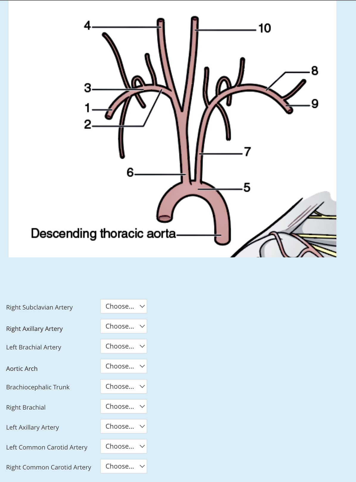 4-
-10
-8
3-
2-
-7
6-
-5
Descending thoracic aorta-
Right Subclavian Artery
Choose...
Choose...
Right Axillary Artery
Left Brachial Artery
Choose...
Choose...
Aortic Arch
Brachiocephalic Trunk
Choose...
Right Brachial
Choose... v
Left Axillary Artery
Choose...
Left Common Carotid Artery
Choose...
Right Common Carotid Artery
Choose...
