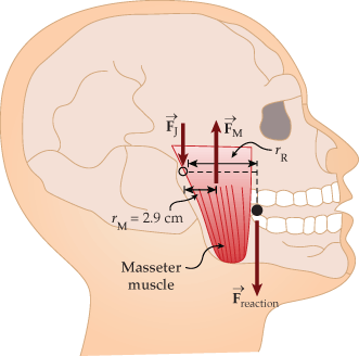 T
IM
F
2.9 cm
Masseter
muscle
FM
F₁
reaction