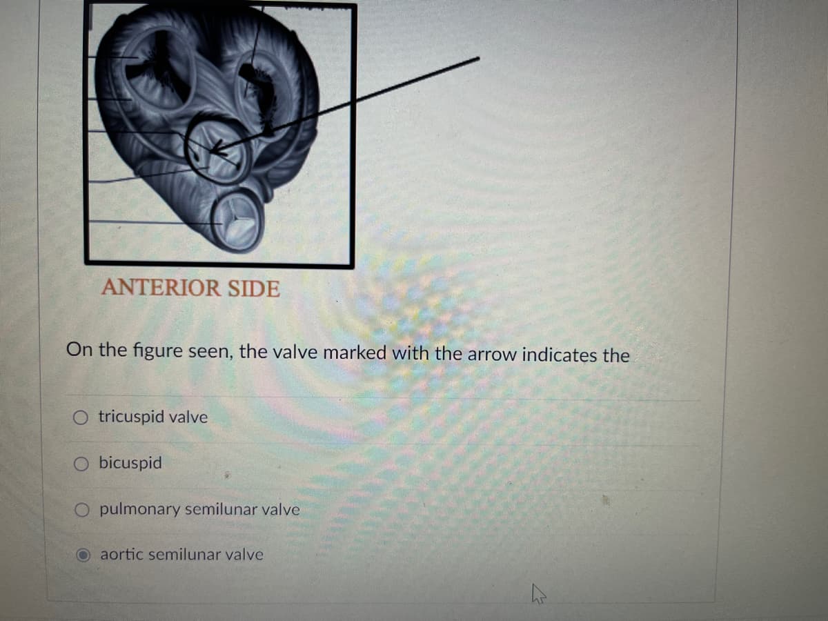 ANTERIOR SIDE
On the figure seen, the valve marked with the arrow indicates the
tricuspid valve
bicuspid
O pulmonary semilunar valve
aortic semilunar valve
