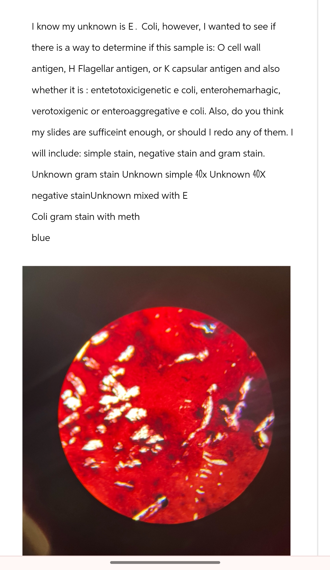 I know my unknown is E. Coli, however, I wanted to see if
there is a way to determine if this sample is: O cell wall
antigen, H Flagellar antigen, or K capsular antigen and also
whether it is: entetotoxicigenetic e coli, enterohemarhagic,
verotoxigenic or enteroaggregative e coli. Also, do you think
my slides are sufficeint enough, or should I redo any of them. I
will include: simple stain, negative stain and gram stain.
Unknown gram stain Unknown simple 40x Unknown 40X
negative stain Unknown mixed with E
Coli gram stain with meth
blue