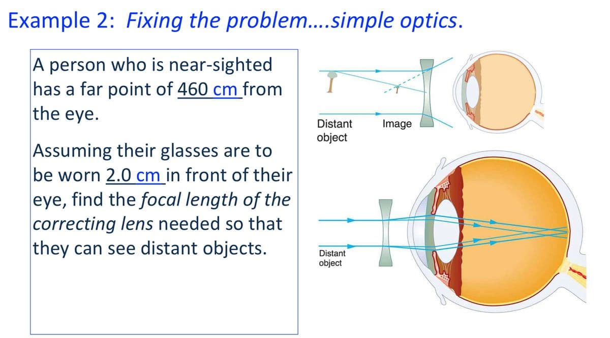 Example 2: Fixing the problem....simple optics.
A person who is near-sighted
has a far point of 460 cm from
the eye.
Assuming their glasses are to
be worn 2.0 cm in front of their
eye, find the focal length of the
correcting lens needed so that
they can see distant objects.
Distant
object
Distant
object
IC
Image