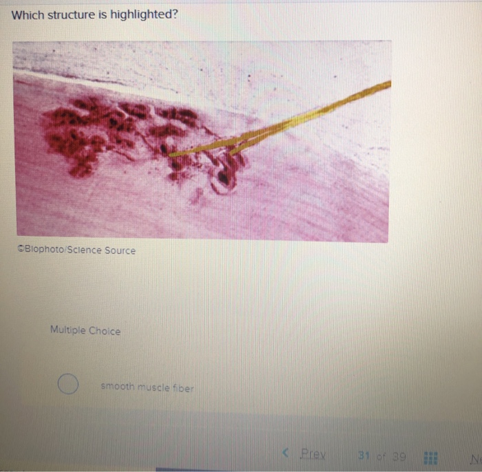 Which structure is highlighted?
Biophoto/Science Source
Multiple Choice
smooth muscle fiber
< Prex
31 of 39
Ne