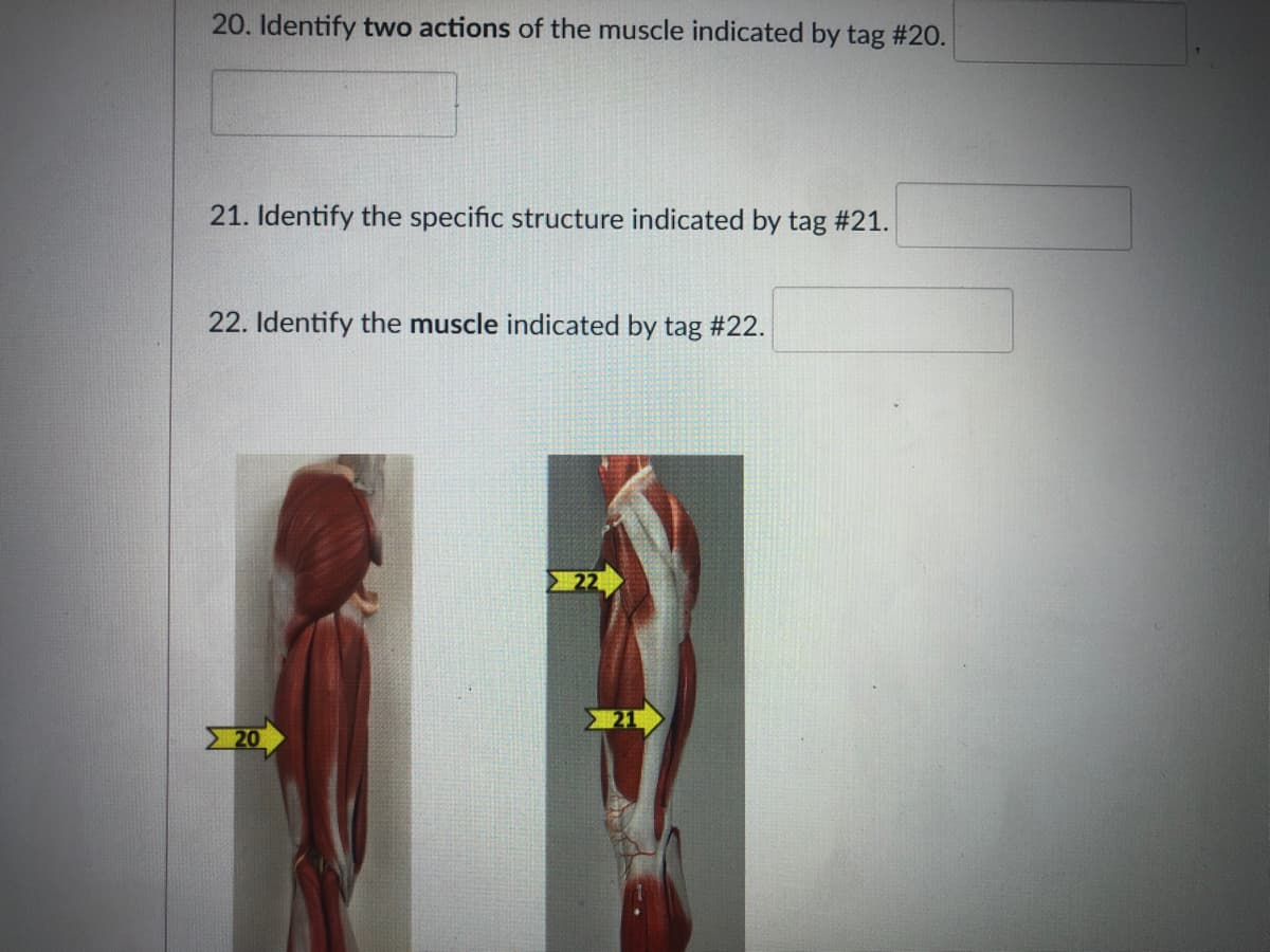 20. Identify two actions of the muscle indicated by tag #20.
21. Identify the specific structure indicated by tag #21.
22. Identify the muscle indicated by tag #22.
22
20
