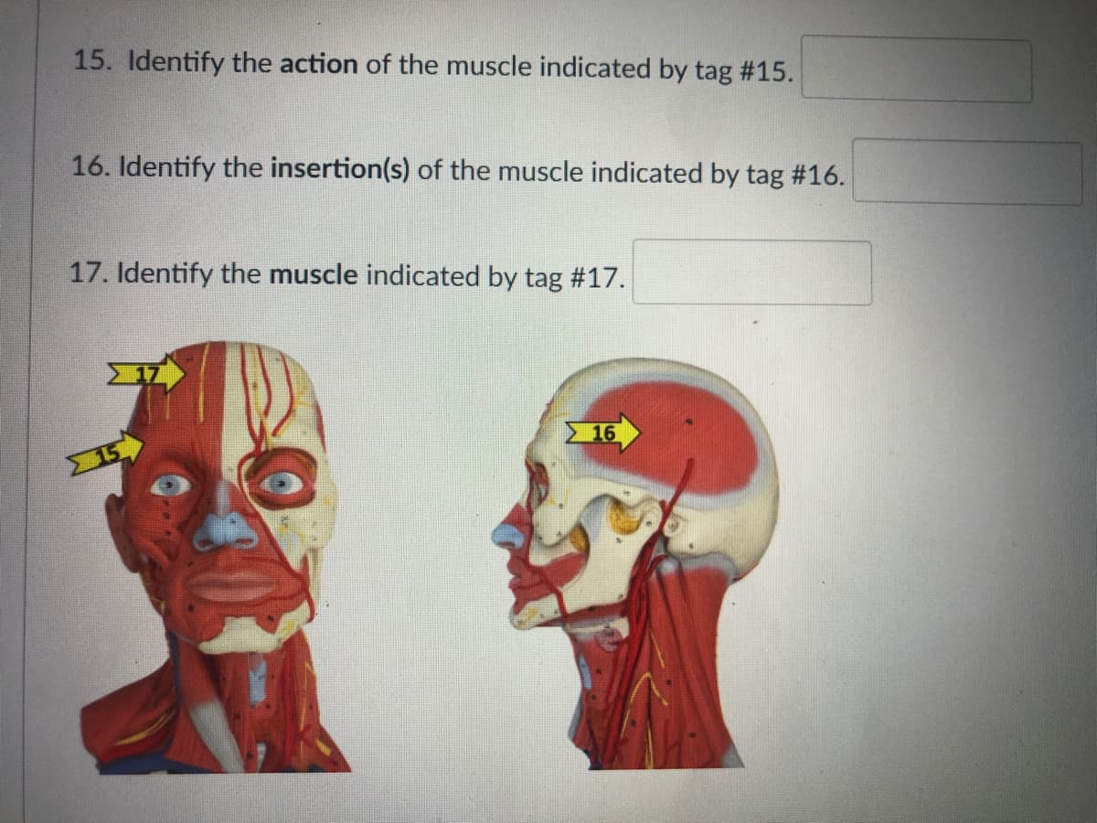 15. Identify the action of the muscle indicated by tag #15.
16. Identify the insertion(s) of the muscle indicated by tag #16.
17. Identify the muscle indicated by tag #17.
15
16
