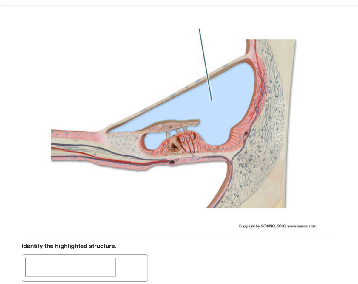 Copytighil by SOMSO, 2010, www sare CI
Identify the highlighted structure.
