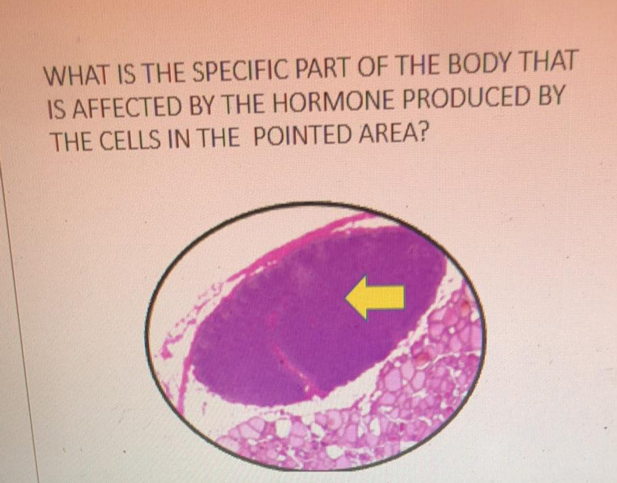 WHAT IS THE SPECIFIC PART OF THE BODY THAT
IS AFFECTED BY THE HORMONE PRODUCED BY
THE CELLS IN THE POINTED AREA?
