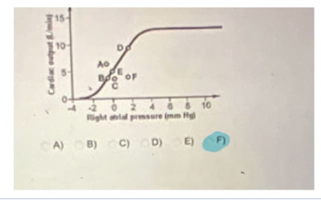 Cofial output ம்ம்
10-
Ao
OF
2
Right obial pressure (mm Hg)
E
8 10
A) B) C) D)
F)