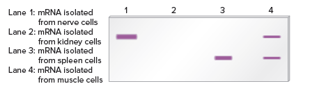 Lane 1: MRNA isolated
1
2
3
4
from nerve cells
Lane 2: MRNA isolated
from kidney cells
Lane 3: MRNA isolated
from spleen cells
Lane 4: MRNA isolated
from muscle cells
