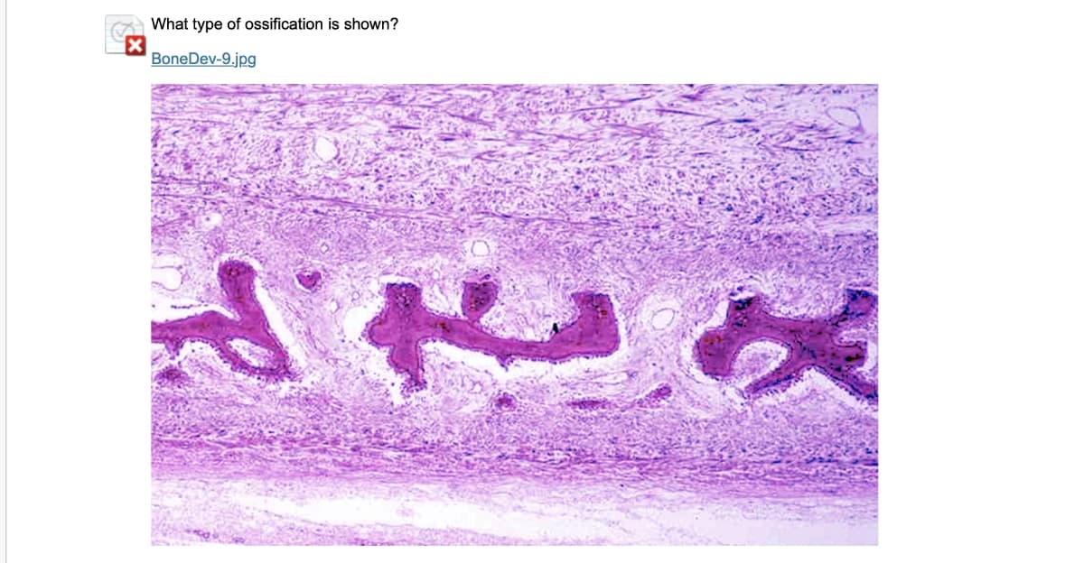 What type of ossification is shown?
BoneDev-9.jpg

