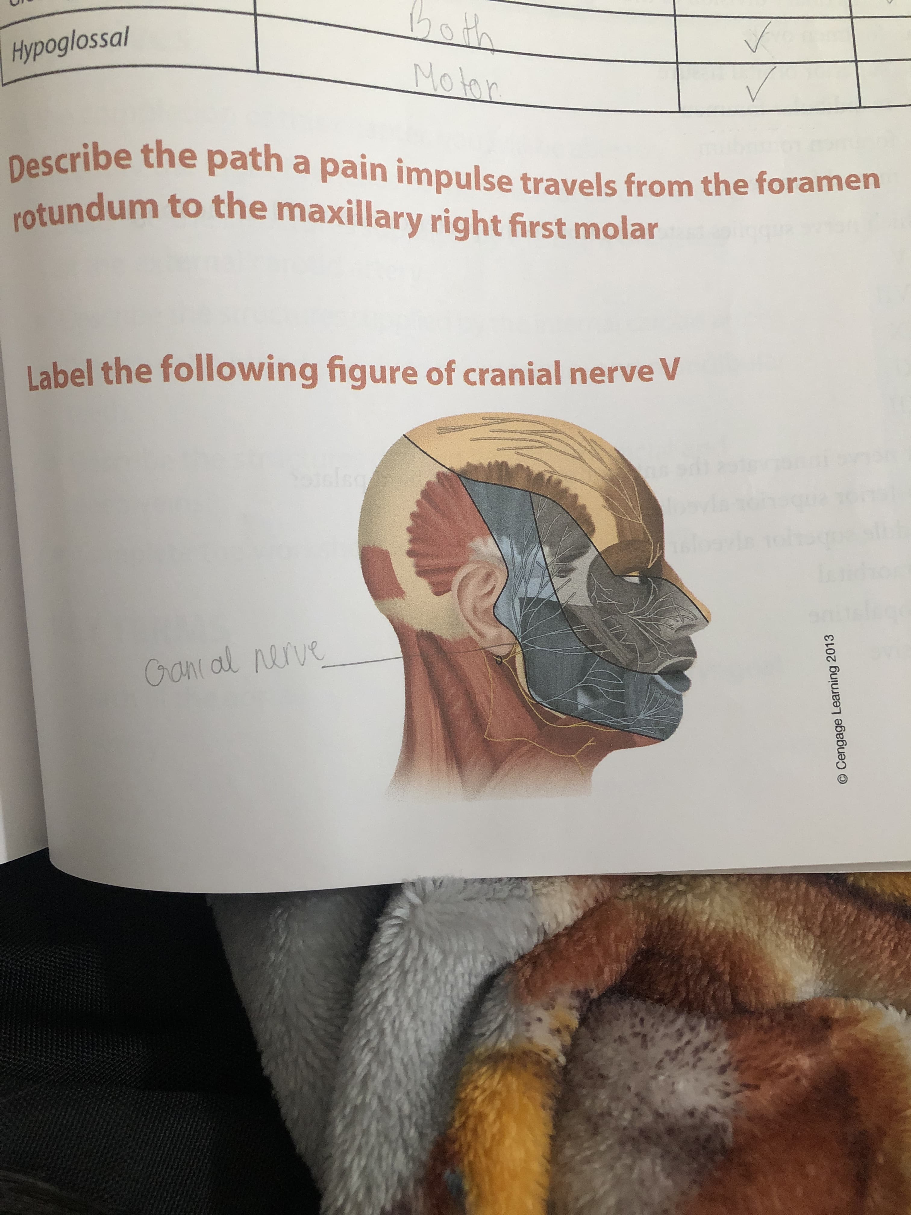 Describe the path a pain impulse travels from the foramen
votundum to the maxillary right first molar
Label the following figure of cranial nerve V
