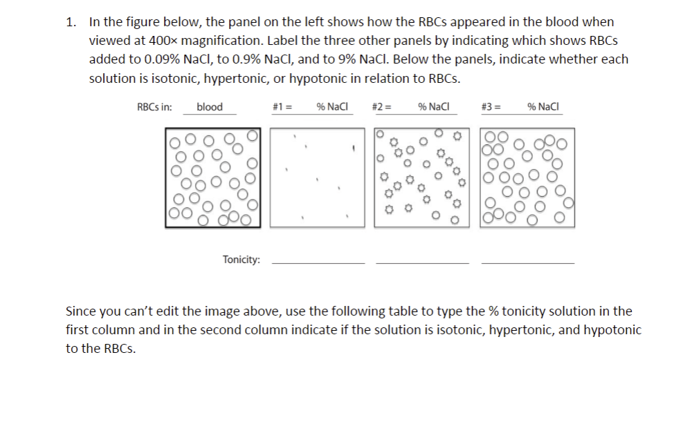 1. In the figure below, the panel on the left shows how the RBCs appeared in the blood when
viewed at 400x magnification. Label the three other panels by indicating which shows RBCs
added to 0.09% NaCl, to 0.9% NaCl, and to 9% NaCl. Below the panels, indicate whether each
solution is isotonic, hypertonic, or hypotonic in relation to RBCs.
RBCs in:
% NaCl
blood
Tonicity:
# 1 =
#2 =
% NaCl
#3 =
% NaCl
Since you can't edit the image above, use the following table to type the % tonicity solution in the
first column and in the second column indicate if the solution is isotonic, hypertonic, and hypotonic
to the RBCs.