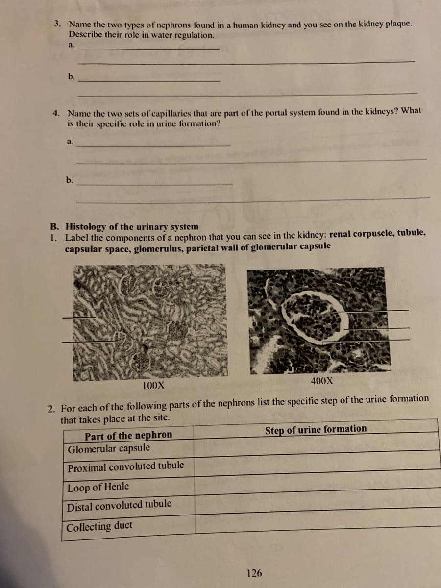 3. Name the two types of nephrons found in a human kidney and you see on the kidney plaque.
Describe their role in water regulation.
a.
b.
4. Name the two sets of capillaries that are part of the portal system found in the kidneys? What
is their specific role in urine formation?
a.
b.
B. Histology of the urinary system
1. Label the components of a nephron that you can see in the kidney: renal corpuscle, tubule,
capsular space, glomerulus, parictal wall of glomerular capsule
100X
400X
2. For each of the following parts of the nephrons list the specific step of the urine formation
that takes place at the site.
Part of the nephron
Glomerular capsule
Step of urine formation
Proximal convoluted tubule
Loop of Henle
Distal convoluted tubule
Collecting duct
126
