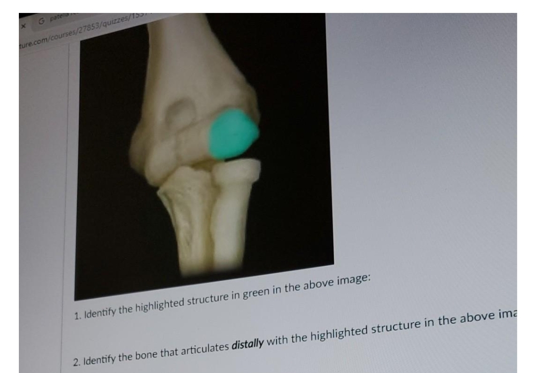 G pate
ture.com/courses/27853/quizzes/155
1. Identify the highlighted structure in green in the above image:
2. Identify the bone that articulates distally with the highlighted structure in the above ima
