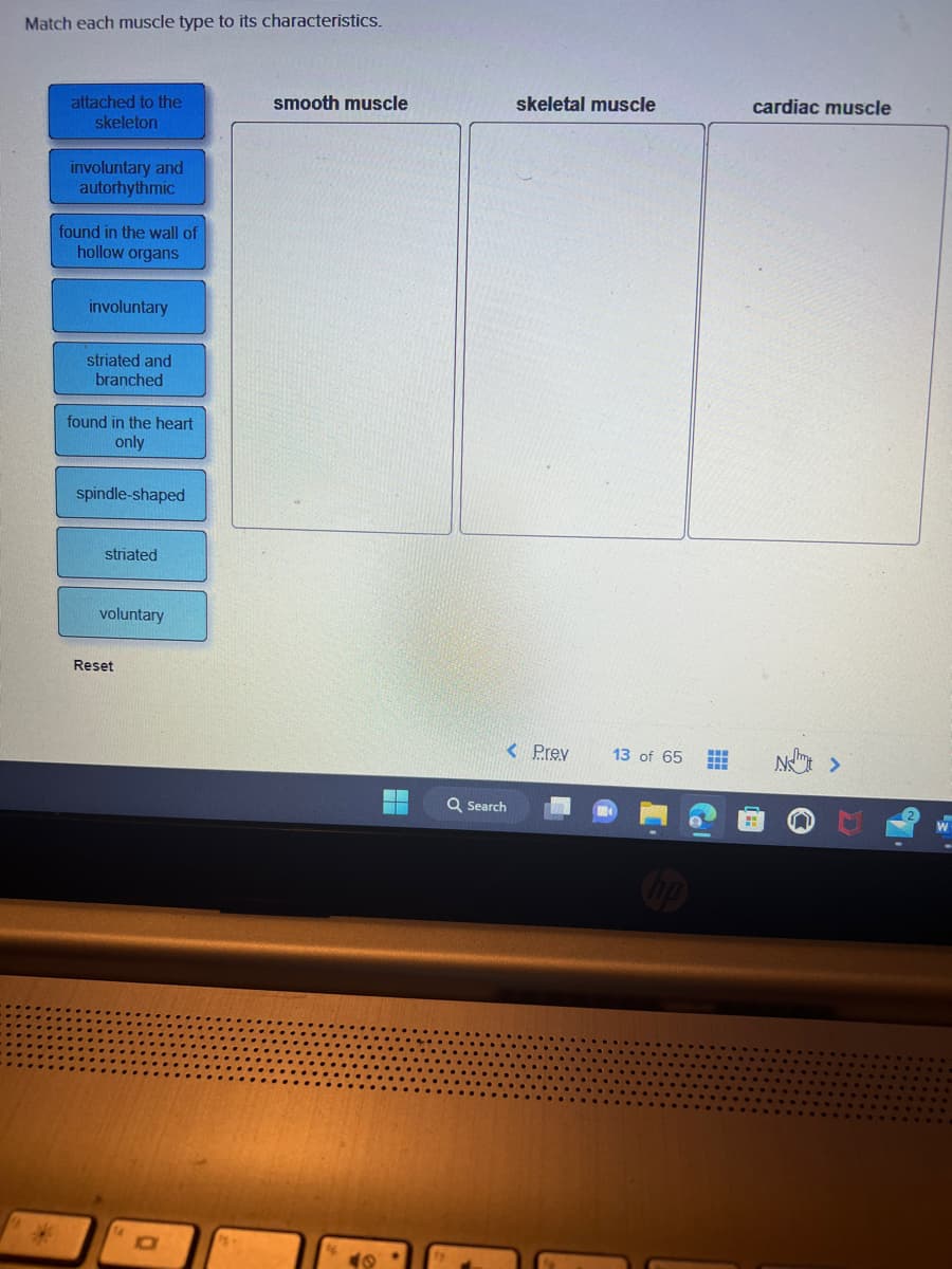 Match each muscle type to its characteristics.
attached to the
skeleton
involuntary and
autorhythmic
found in the wall of
hollow organs
involuntary
striated and
branched
found in the heart
only
spindle-shaped
striated
voluntary
Reset
O
smooth muscle
‒‒
skeletal muscle
< Prev
Q Search
13 of 65
hp
www
II
cardiac muscle
N >