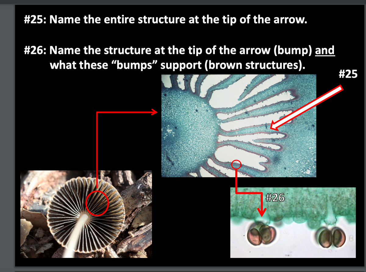 # 25: Name the entire structure at the tip of the arrow.
# 26: Name the structure at the tip of the arrow (bump) and
what these "bumps" support (brown structures).
#25
#26
