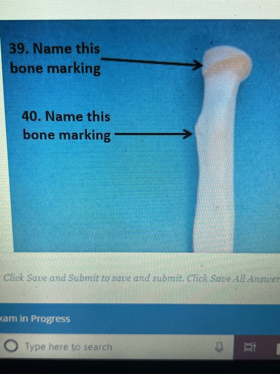 39. Name this
bone marking
40. Name this
bone marking
Click Save and Submit to save and submit. Click Save All Answer
xam in Progress
OType here to search