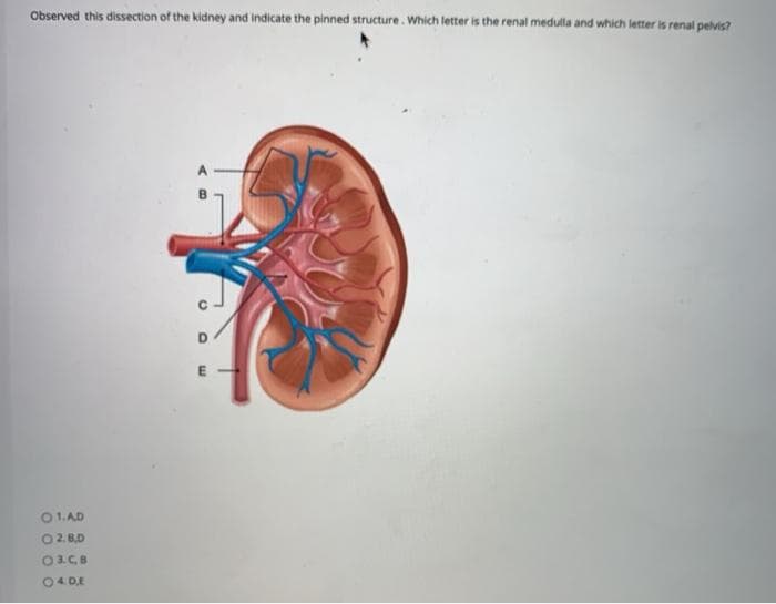 Observed this dissection of the kidney and indicate the pinned structure. Which letter is the renal medulla and which letter is renal pelvis?
01.AD
O 2.8.0
O 3.C.B
○
4. DE