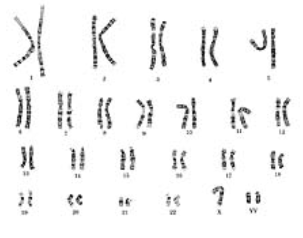 The image displays a human karyotype, which is an organized profile of a person's chromosomes. Chromosomes are depicted and grouped according to their number and structures. From this karyotype, here is the detailed transcription:

1. Chromosome pair 1
2. Chromosome pair 2
3. Chromosome pair 3
4. Chromosome pair 4
5. Chromosome pair 5
6. Chromosome pair 6
7. Chromosome pair 7
8. Chromosome pair 8
9. Chromosome pair 9
10. Chromosome pair 10
11. Chromosome pair 11
12. Chromosome pair 12
13. Chromosome pair 13
14. Chromosome pair 14
15. Chromosome pair 15
16. Chromosome pair 16
17. Chromosome pair 17
18. Chromosome pair 18
19. Chromosome pair 19
20. Chromosome pair 20
21. Chromosome pair 21
22. Chromosome pair 22
23. Sex chromosomes (X and Y)

Each chromosome pair is numbered from 1 to 22, with the sex chromosomes listed at the end (XX for females and XY for males). This type of diagram is fundamental in genetics for identifying chromosomal abnormalities and understanding chromosomal behavior during reproduction.