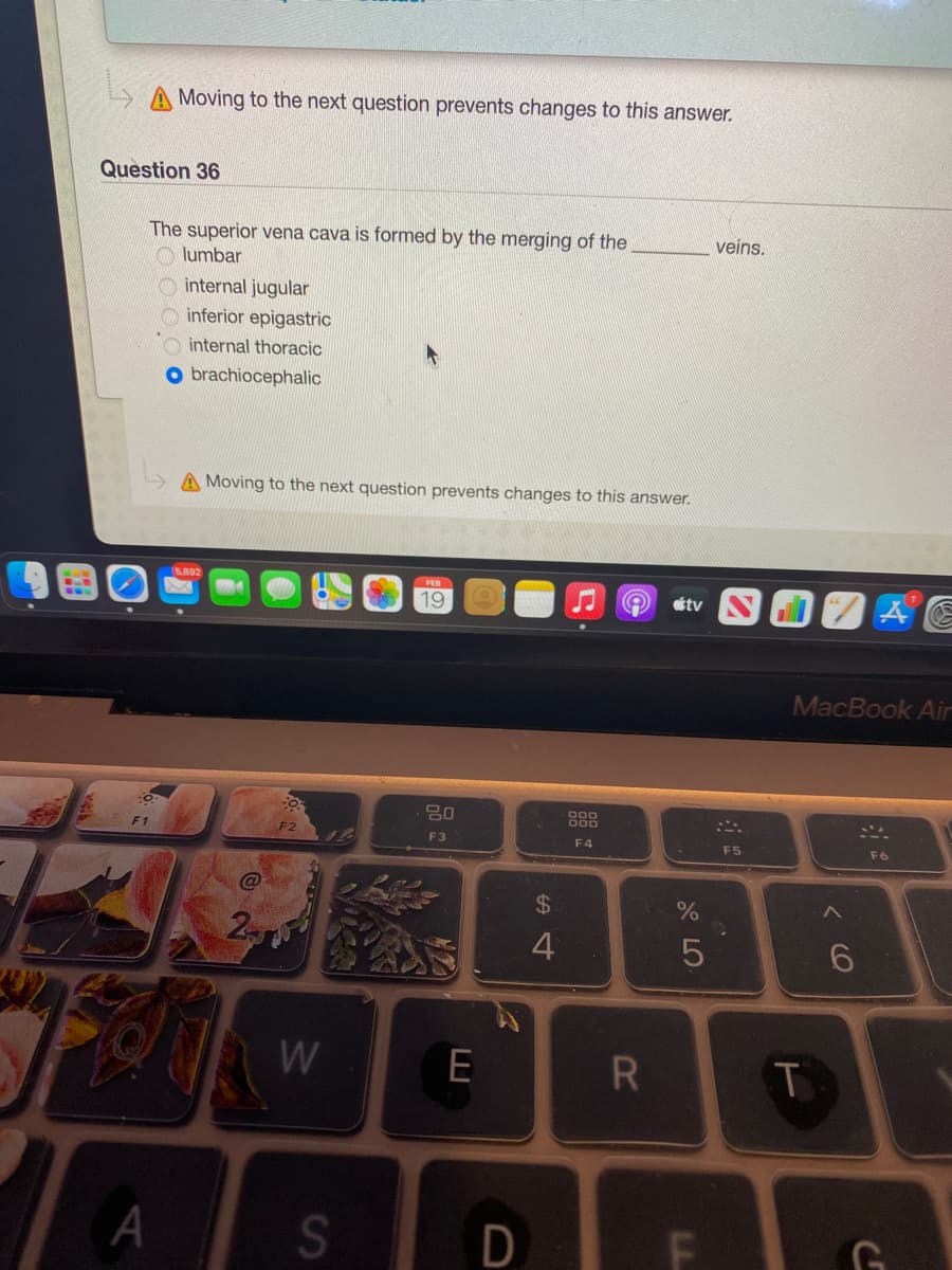 Moving to the next question prevents changes to this answer.
Question 36
The superior vena cava is formed by the merging of the
O lumbar
veins.
O internal jugular
O inferior epigastric
internal thoracic
O brachiocephalic
A Moving to the next question prevents changes to this answer.
FE
19
tv
MacBook Air
80
F3
F4
F5
F6
24
2
4
A
D
CI
LL
R
