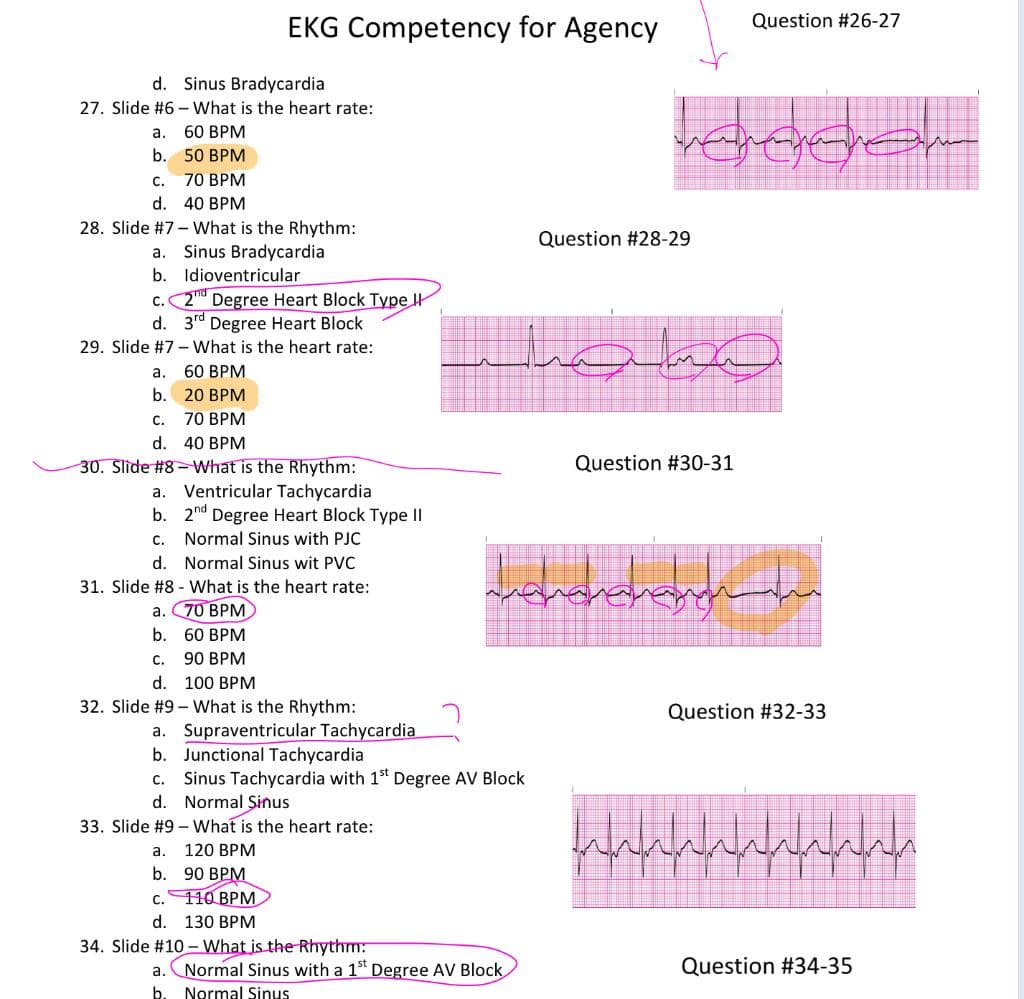 Question #26-27
EKG Competency for Agency
d. Sinus Bradycardia
27. Slide #6 - What is the heart rate:
а.
60 BPM
b. 50 BPM
C.
70 BPM
d. 40 BPM
28. Slide #7- What is the Rhythm:
a. Sinus Bradycardia
Question #28-29
b. Idioventricular
c. 2nd Degree Heart Block Type I
d. 3rd Degree Heart Block
29. Slide #7 - What is the heart rate:
а.
60 ВРМ
b. 20 ВРМ
С.
70 BPM
d. 40 BPM
Question #30-31
30. Slide #8-What is the Rhythm:
Ventricular Tachycardia
b. 2nd Degree Heart Block Type II
c. Normal Sinus with PJC
a.
d. Normal Sinus wit PVC
31. Slide #8 - What is the heart rate:
а. 70 ВРМ
b. 60 BPM
C.
90 ВРМ
d. 100 BPM
32. Slide #9 - What is the Rhythm:
Question #32-33
Supraventricular Tachycardia
b. Junctional Tachycardia
c. Sinus Tachycardia with 1st Degree AV Block
d. Normal Sinus
а.
33. Slide #9 - What is the heart rate:
а.
120 BPM
b. 90 BPM
c. 110 BPM
d. 130 BPM
34. Slide #10 - What is the Rhythm:
a.
Normal Sinus with a 1st Degree AV Block
Question #34-35
Normal Sinus
