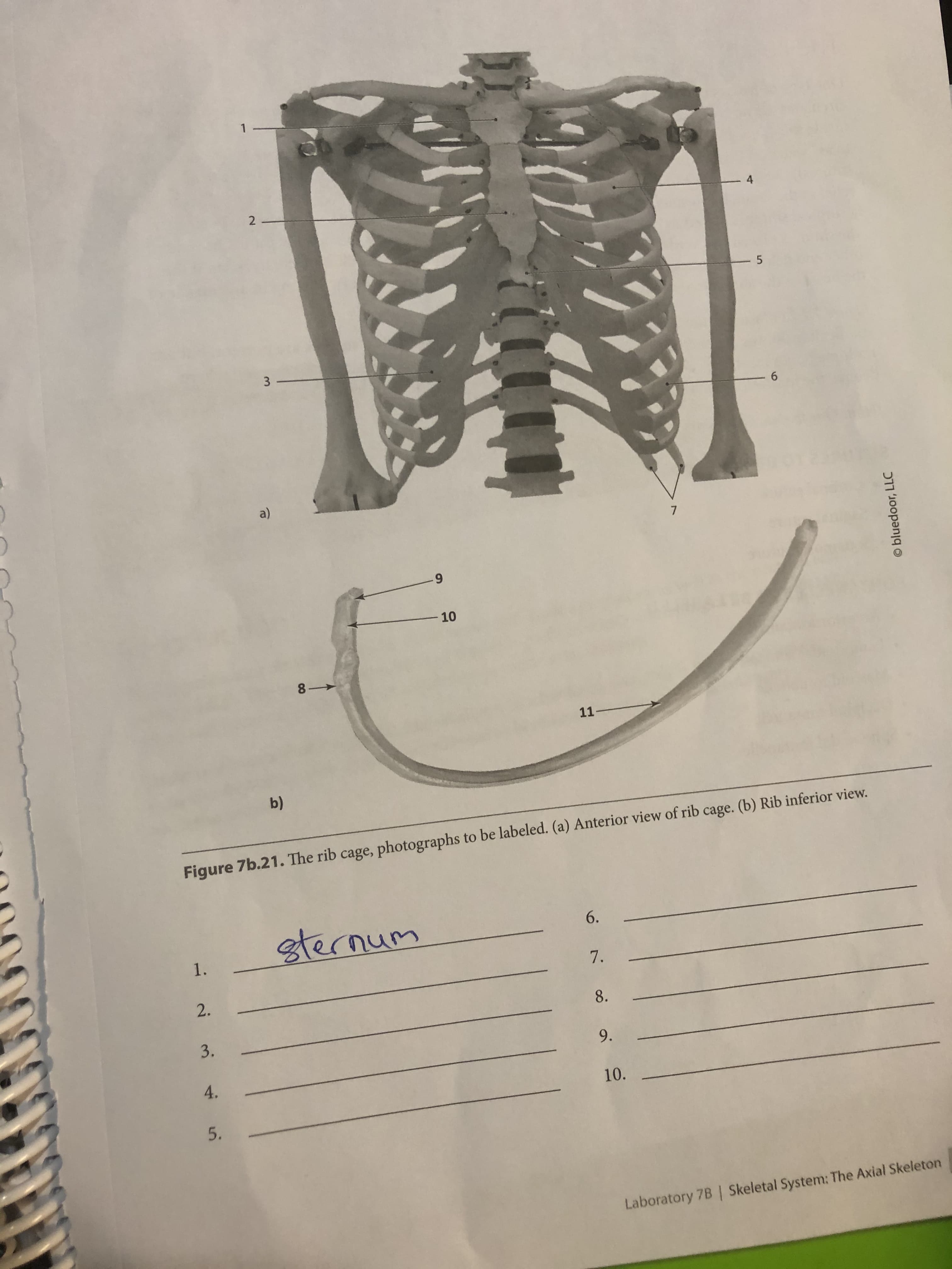 4
2
6.
a)
10
11-
b)
Figure 7b.21. The rib cage, photographs to be labeled. (a) Anterior view of rib cage. (b) Rib inferior view.
6.
sternum
1.
7.
2.
8.
3.
9.
4.
10.
Laboratory 7B | Skeletal System: The Axial Skeleton
O bluedoor, LLC
5.
3.
5.
