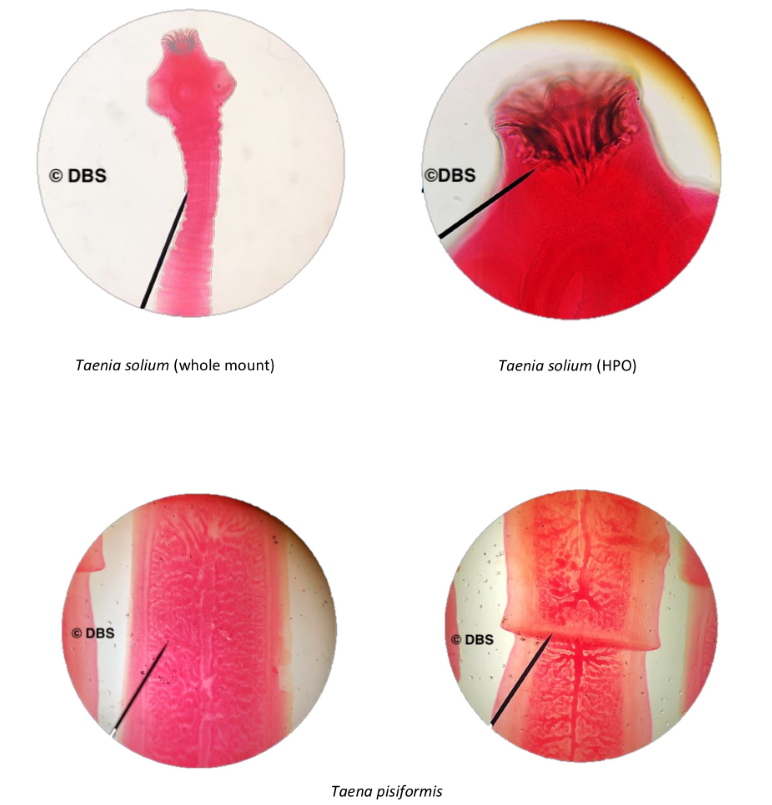 © DBS
©DBS
Taenia solium (whole mount)
Taenia solium (HPO)
© DBS
© DBS
Taena pisiformis
