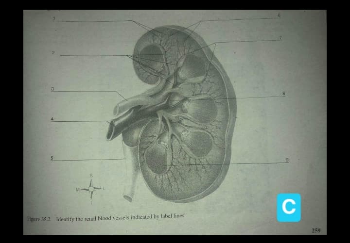 2.
3
M
C
Figure 35.2 Identify the renal blood vessels indicated by label lines.
259
