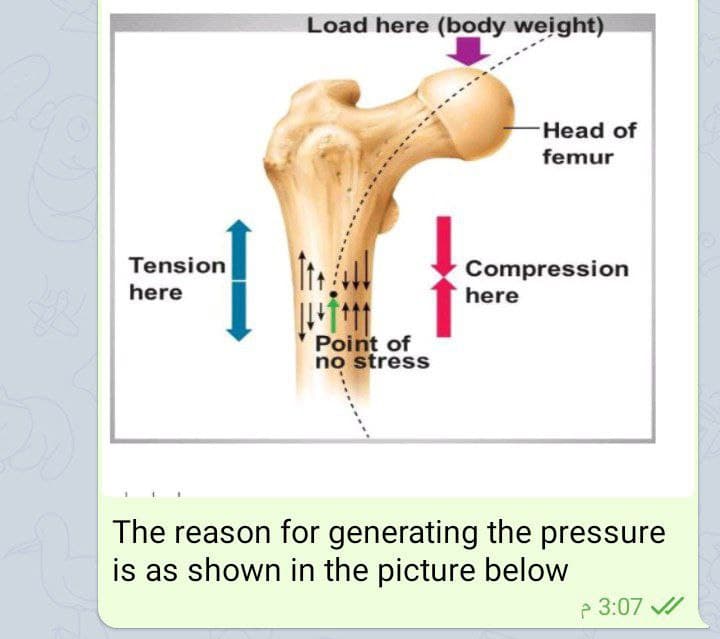 Load here (body weight)
Head of
femur
Tension
Compression
here
here
Point of
no stress
The reason for generating the pressure
is as shown in the picture below
P 3:07 /
