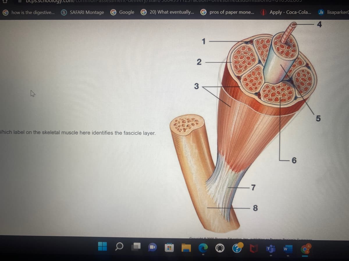 Commo1-assessTTment-de
G how is the digestive...
S SAFARI Montage
G Google
© 20) What eventually...
pros of paper mone...
Apply - Coca-Cola..
li lisaparker0
Vhich label on the skeletal muscle here identifies the fascicle layer.
6.
-7
8.
