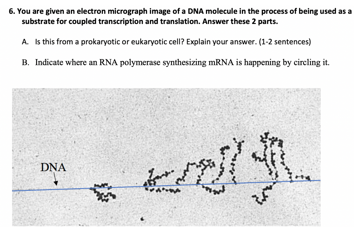 6. You are given an electron micrograph image of a DNA molecule in the process of being used as a
substrate for coupled transcription and translation. Answer these 2 parts.
A. Is this from a prokaryotic or eukaryotic cell? Explain your answer. (1-2 sentences)
B. Indicate where an RNA polymerase synthesizing MRNA is happening by circling it.
DNA
