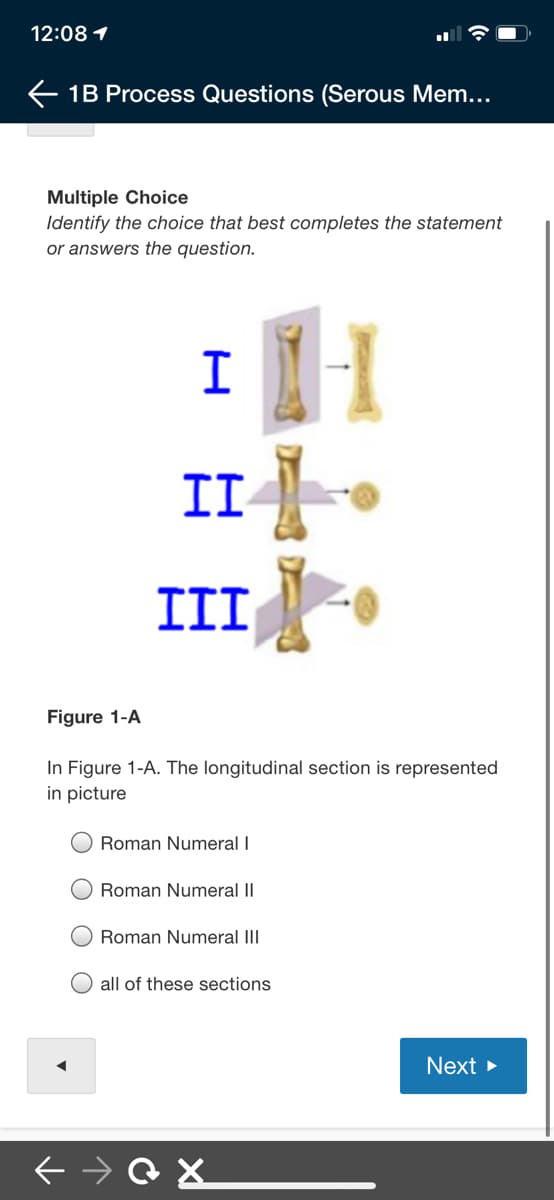 12:08 1
E 1B Process Questions (Serous Mem...
Multiple Choice
Identify the choice that best completes the statement
or answers the question.
II
III
Figure 1-A
In Figure 1-A. The longitudinal section is represented
in picture
Roman Numeral I
Roman Numeral II
Roman Numeral III
all of these sections
Next >
