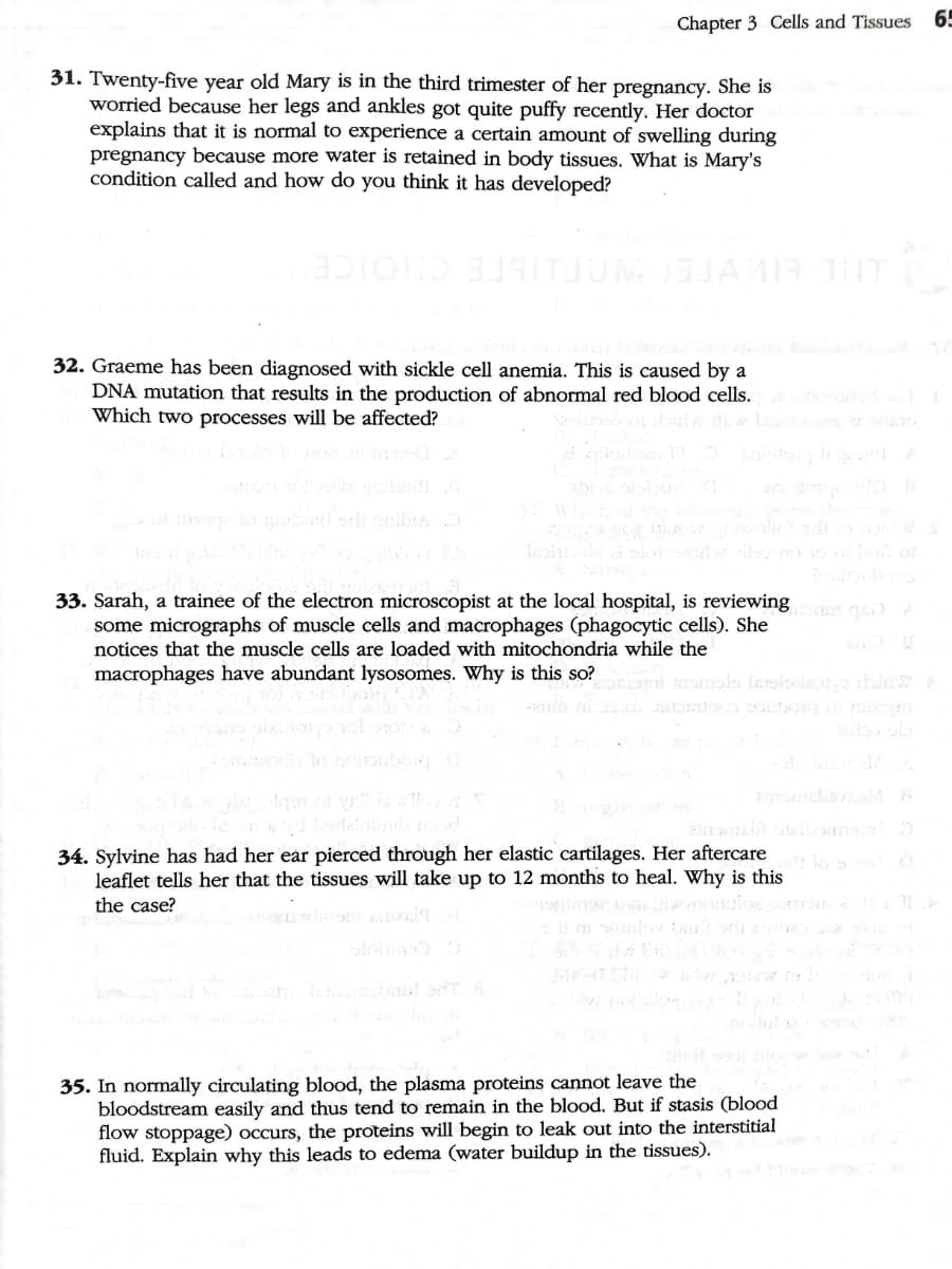 Chapter 3 Cells and Tissues
65
31. Twenty-five year old Mary is in the third trimester of her pregnancy. She is
worried because her legs and ankles got quite puffy recently. Her doctor
explains that it is normal to experience a certain amount of swelling during
pregnancy because more water is retained in body tissues. What is Mary's
condition called and how do you think it has developed?
LHE EIVE AIbrE CHOICE
32. Graeme has been diagnosed with sickle cell anemia. This is caused by a
DNA mutation that results in the production of abnormal red blood cells.
Which two processes will be affected?
33. Sarah, a trainee of the electron microscopist at the local hospital, is reviewing t as) A
some micrographs of muscle cells and macrophages (phagocytic cells). She
notices that the muscle cells are loaded with mitochondria while the
macrophages have abundant lysosomes. Why is this so?
Sallo o
aino M 6
34. Sylvine has had her ear pierced through her elastic cartilages. Her aftercare
leaflet tells her that the tissues will take up to 12 months to heal. Why is this
the case?
35. In normally circulating blood, the plasma proteins cannot leave the
bloodstream easily and thus tend to remain in the blood. But if stasis (blood
flow stoppage) occurs, the proteins will begin to leak out into the interstitial
fluid. Explain why this leads to edema (water buildup in the tissues).
