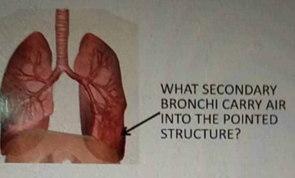 WHAT SECONDARY
BRONCHI CARRY AIR
INTO THE POINTED
STRUCTURE?
