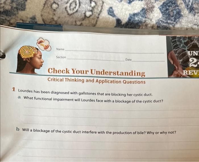 Name
Section
Date
Check Your Understanding
Critical Thinking and Application Questions
1 Lourdes has been diagnosed with gallstones that are blocking her cystic duct.
a What functional impairment will Lourdes face with a blockage of the cystic duct?
b Will a blockage of the cystic duct interfere with the production of bile? Why or why not?
UN
2-
REV