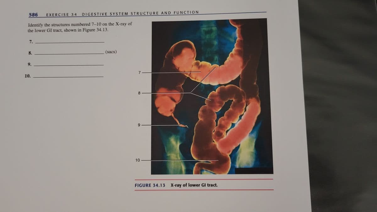 586
DIGESTIVE SYSTEM STRUCTURE AND FUNCTION
EXERCISE 34
Identify the structures numbered 7-10 on the X-ray of
the lower GI tract, shown in Figure 34.13.
7.
8.
(sacs)
9.
10.
8
9 -
10
FIGURE 34.13 X-ray of lower GI tract.
